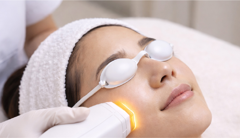 フォトフェイシャル