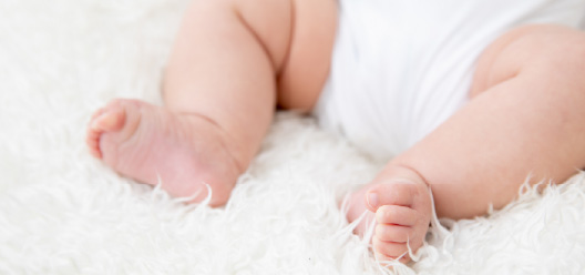 小児発育性股関節形成不全症