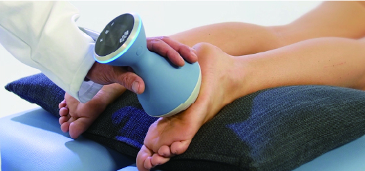 体外衝撃波治療